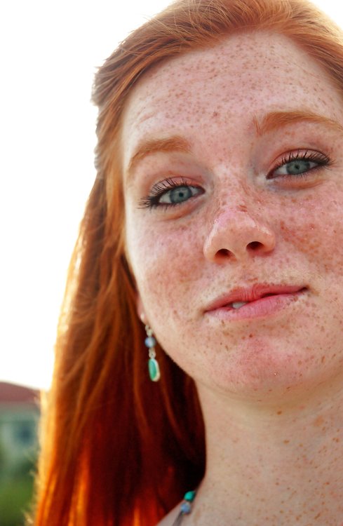 Freckles miniskirt dyke solo